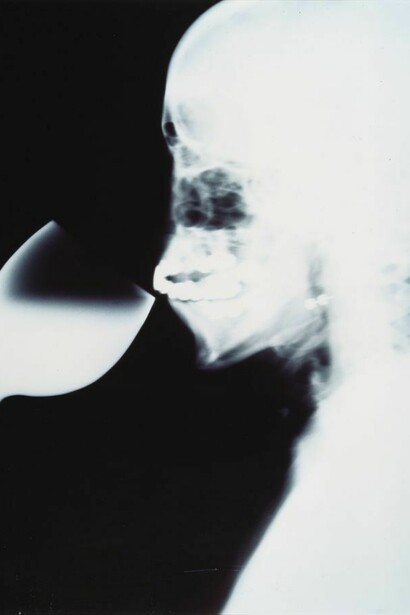 Isa Genzken, X-Ray, 1991. Courtesy Städtische Galerie im Lenbachhaus, Munich. © Isa Genzken.