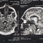 James Drake, The Anatomy of Drawing and Space (Brain Trash) –  from Chapter 6 (detail), 2012-2013, mixed media on paper. Courtesy of the artist. ©James Drake 2013.
