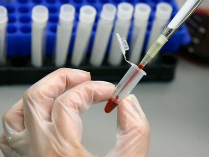 Profilassi e prevenzione