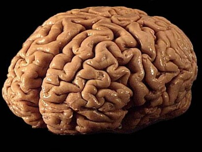 El cerebro humano