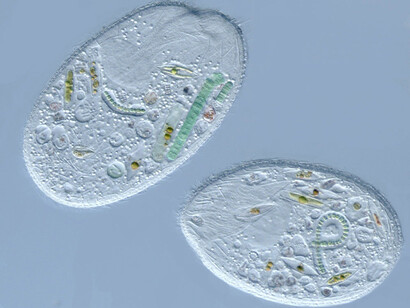 Sonderia sp. (organismo ciliado). Fotografía: Diana Lipscomb, George Washington University, Washington, D.C.