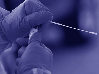 Occorre inserire psicologi e psicoterapeuti in tutti i reparti ospedalieri d’Italia, al fine di poter garantire il dovuto supporto psicologico agli eroi coinvolti in “prima linea” in questa pandemia