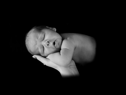 Alcuni bimbi possono presentare arrossamenti diffusi a causa di cibi troppo complessi per il loro sistema digestivo