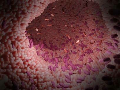 L' alterazione del microbiota intestinale può essere causato da cambiamenti di regime alimentare, dall'assunzione di bevande o cibi contaminati da agenti patogeni, dalla perdita di peso, cambi di clima, ansia e stress