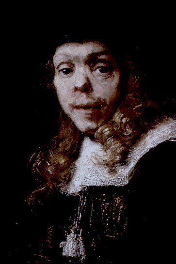 Retrato de Gerard de Lairesse por Rembrandt van Rijn (1665–67) — De Lairesse, también pintor padecía sífilis hereditaria 