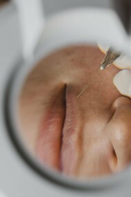 With minimal cost and less recovery than surgery, dermal fillers are a cornerstone of modern, accessible aesthetics