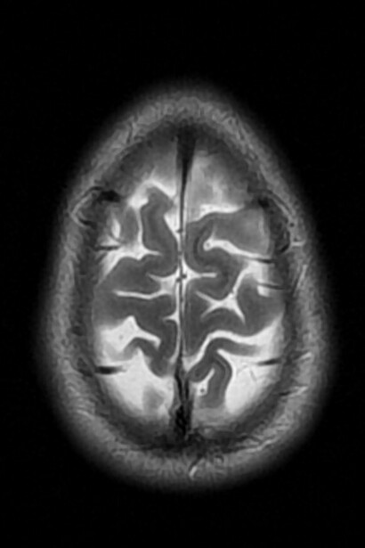 Resonancia magnética del cerebro humano