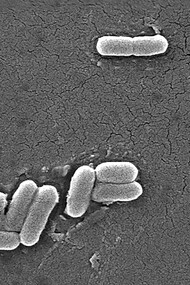 La célèbre Escherichia coli, hôte de nos intestins. Inoffensive le plus souvent, elle contribue à la digestion de nos aliments, mais quelques souches peuvent s’avérer pathogènes et dangereuses