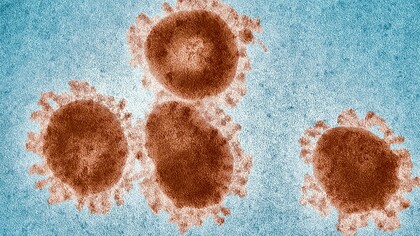 Les bactériophages sont des virus naturels très répandus dans l'environnement qui ciblent spécifiquement les bactéries