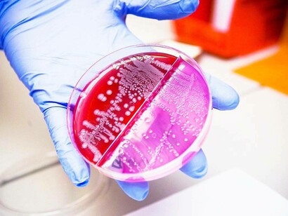 Capsula di Petri contenente il batterio Escherichia coli