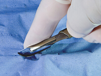 Scalpello Chirurgico, Tudor Barker