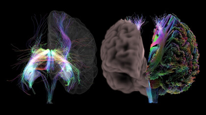 Modelos del cerebro humano desarrollados por el Human Brain Project
