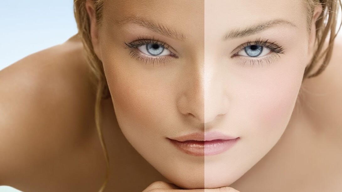 Antes y después de un tratamiento para blanquear la piel