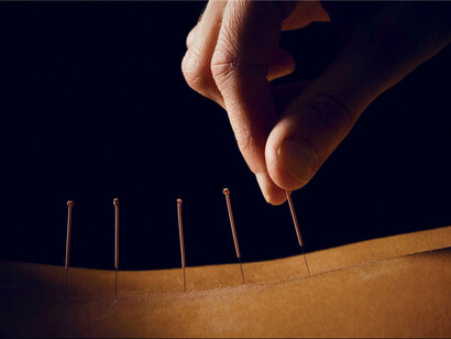 Bian Que and the Traditional Chinese Medicine: Acupuncture and Moxibustion 