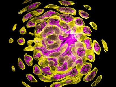 These findings demonstrate that moderate physical exercise empowers immune cells to clear potential threats and prevent breast cancer