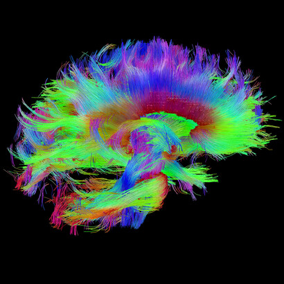Our approach to data analysis of attention, memory, and behavioral dynamics of decision making derives from the internal states of the atomic structure of binding synergies