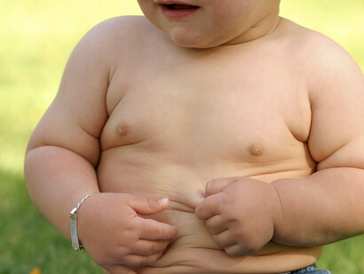 Childhood obesity is one of the most serious  health challenges of the 21st century