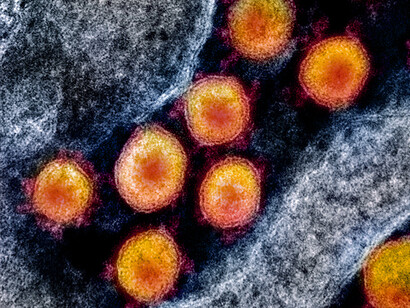 El virus SARS-COV-2 bajo el microscopio