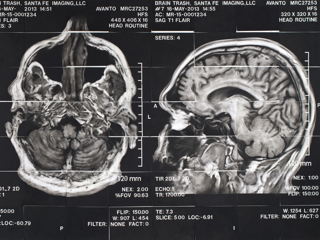 James Drake, The Anatomy of Drawing and Space (Brain Trash) –  from Chapter 6 (detail), 2012-2013, mixed media on paper. Courtesy of the artist. ©James Drake 2013.