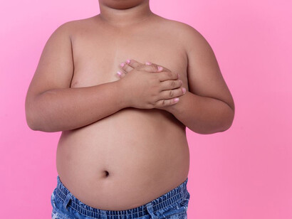 Niño con obesidad: este problema de salud comienza cada vez a edades más tempranas
