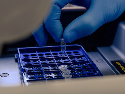 A lab worker carefully sorts and stores pipette tips in a blue container, enhancing the efficiency of genetic testing tasks