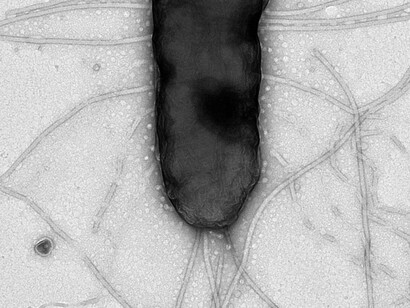Célula de Pseudomonas observada em microscopia eletrônica, com destaque para seus flagelos. A identificação de cepas seguras é essencial para transformar esses microrganismos em tecnologias voltadas ao controle biológico e ao aumento da produtividade agrícola