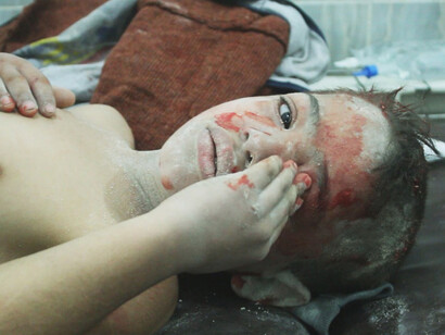 Un bambino ferito in una scena del film "The last men in Aleppo"