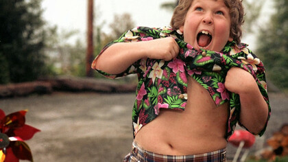 Obesity is bocuming the greatest problem in children and teens