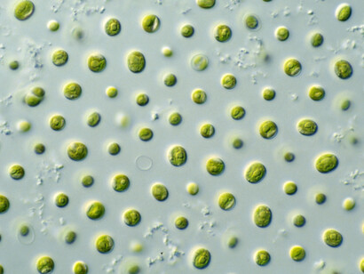 Microalgas