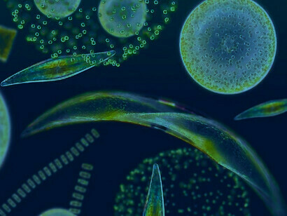 Visão microscópica do fitoplâncton. A taxa de crescimento do fitoplâncton no Oceano Ártico aumentou 57% entre 1998 e 2018