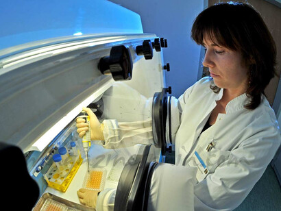 Donación de órganos. Chequeando la viabilidad de las muestras