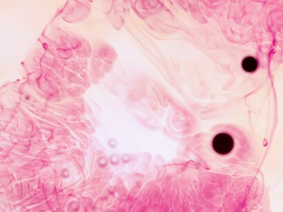Scientists continue to study how viral particles and immune responses affect the placenta during COVID-19 infection