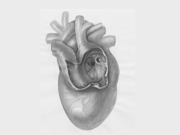 La tomografia coronarica computerizzata si conferma uno strumento rilevante per la diagnosi e la prevenzione delle patologie cardiovascolari