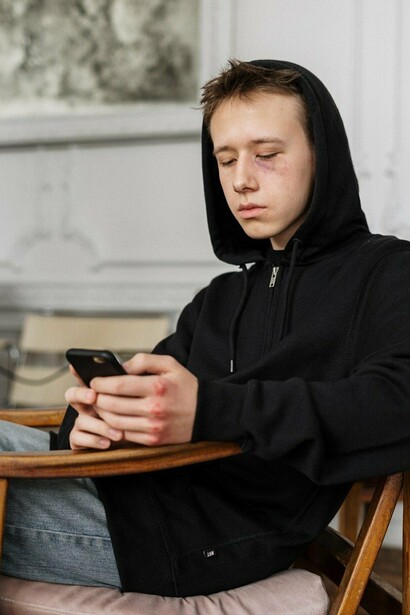 Teenager with bruised eye looks at phone