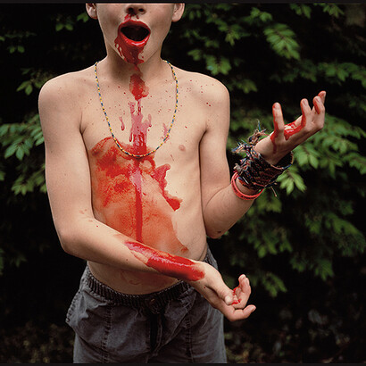Sally Mann, Bloody Nose, 1991, silver dye bleach print, Private collection. Image © Sally Mann


