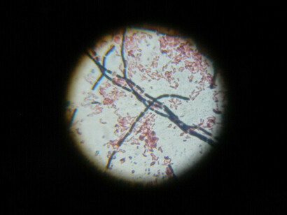 Coloración de Gram de Bacillus cereus y Escherichia coli. La piel alberga una flora bacteriana transitoria que puede convertirse en vehículo de enfermedades si no se elimina adecuadamente