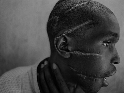 James Nachtwey. Ruanda. 1994