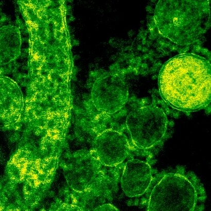 La peste è una delle malattie più famigerate della storia dell'umanità