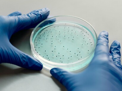 Petri dish layered with bacterial colonies, representing the hidden influencer of our mental and physical states