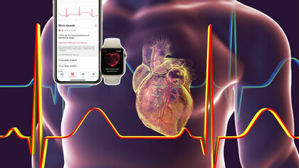L'Apple Watch 4 è in grado di registrare un tracciato elettrocardiografico