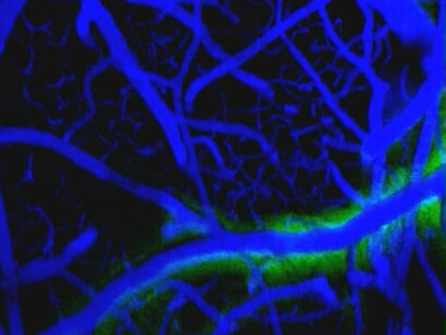 Se ha inyectado un tinte fluorescente en el animal para permitir la visualización de la dinámica del líquido cefalorraquídeo en un ratón que duerme