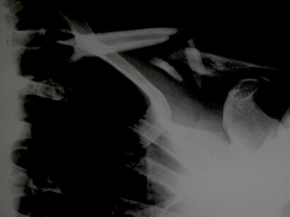 Radiografía