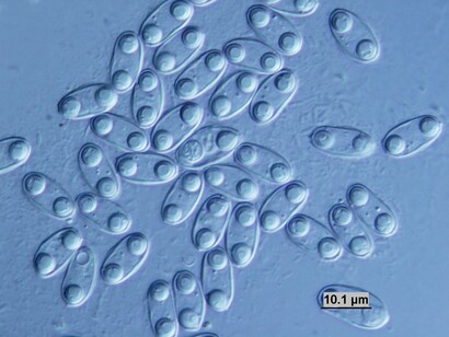 Chloromyxum cristatum
