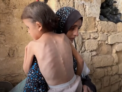 La nueva época se diferenciará radicalmente del genocidio de los palestinos, al igual que la antigua época nació del recuerdo del genocidio de los judíos. Mayo 2025, los niños están muriendo de inanición