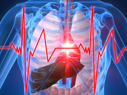 Electrocardograma