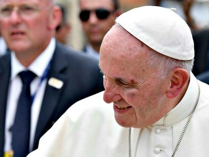 El papa, con el ojo y el pómulo visiblemente magullados