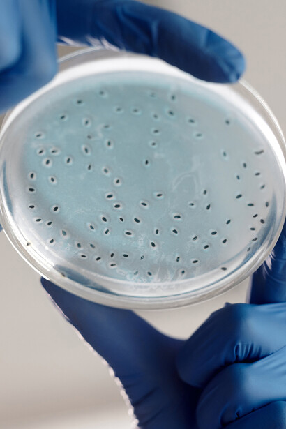 Bactéries. La β-G-ase n’est pas présente dans la cellule bactérienne tant qu’on ne l’a pas nourrie de lactose