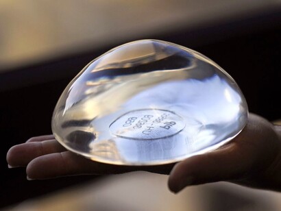 Prótesis de silicona para el pecho