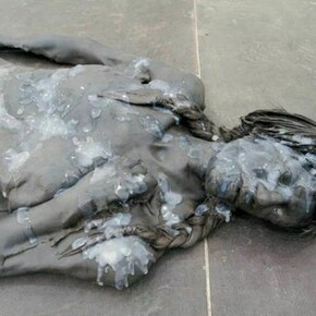 Andra Ursuta, Crush (detail), 2011, Cast urethane, wax, sneakers, wig, silicone. 60 x 40 x 9 in. (152 x 102 x 23 cm). Courtesy of the artist and Ramiken Crucible, New York.