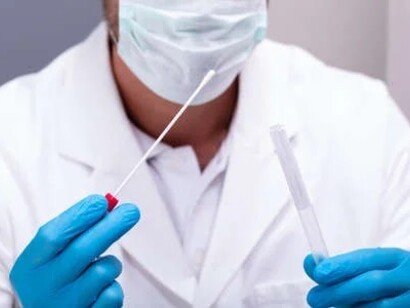 DNA ancestry test: special DNA tests may reveal someone’s heritage or inheritance information